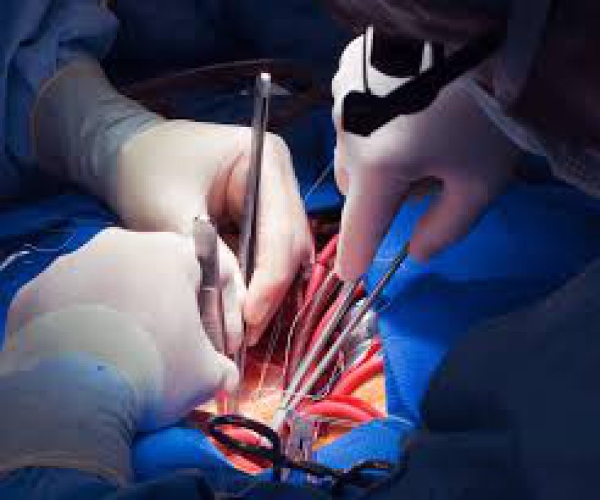 Cardiac Sx