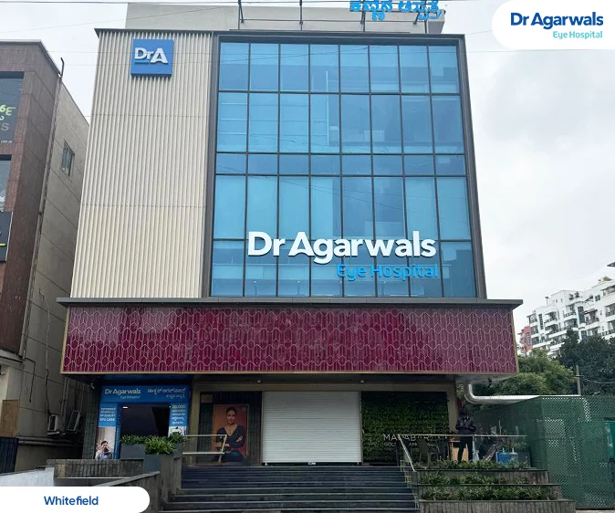 Dr. Aggarwal's Eye Hospital-Chennai
