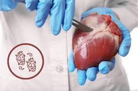 Heart transplant surgery