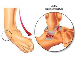 Foot and ankle surgery