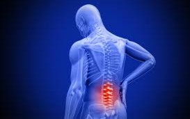 Laminectomy