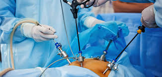 Minimally Invasive Procedures